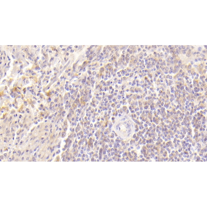 Colony Stimulating Factor 2, Granulocyte Macrophage (GM-CSF) Human Polyclonal Antibody