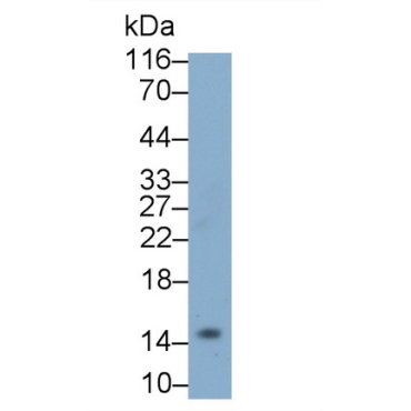 Colony Stimulating Factor 2, Granulocyte Macrophage (GM-CSF) Human Polyclonal Antibody