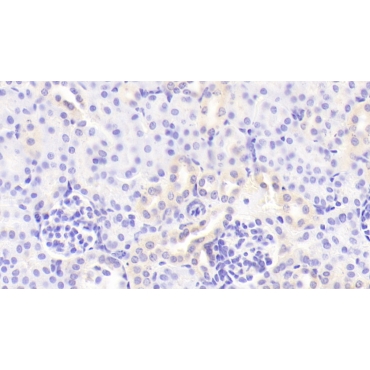 Colony Stimulating Factor 2, Granulocyte Macrophage (GM-CSF) Mouse Polyclonal Antibody