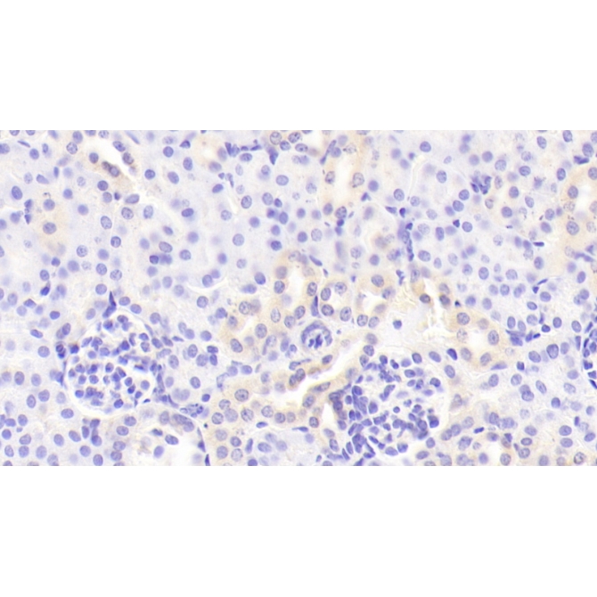 Colony Stimulating Factor 2, Granulocyte Macrophage (GM-CSF) Mouse Polyclonal Antibody