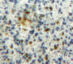 Colony Stimulating Factor 2, Granulocyte Macrophage (GM-CSF) Rat Polyclonal Antibody