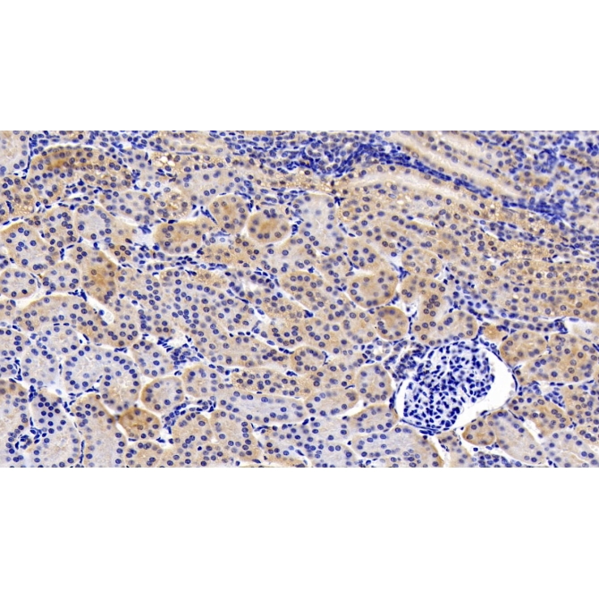 Glycoprotein 130 (gp130) Human Polyclonal Antibody