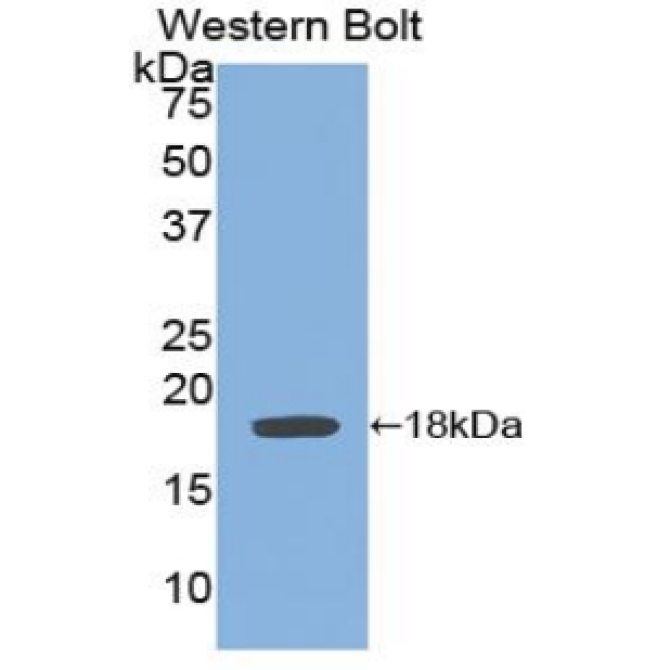 Glycoprotein 130 (gp130) Human Polyclonal Antibody