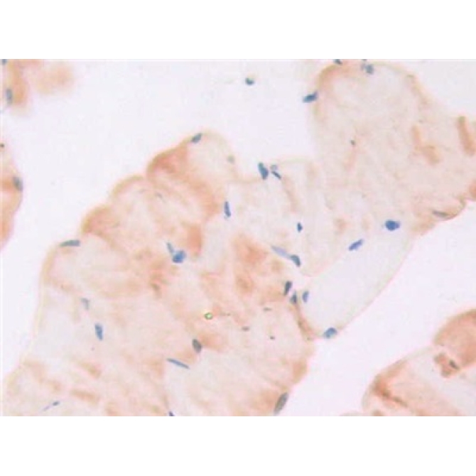 Glycoprotein 130 (gp130) Mouse Polyclonal Antibody