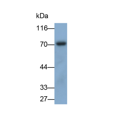 Hepatocyte Growth Factor (HGF) Human Polyclonal Antibody