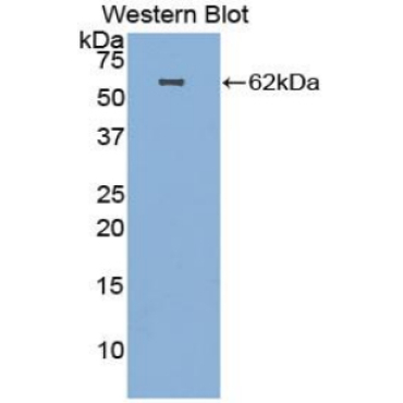 Hepatocyte Growth Factor (HGF) Human Polyclonal Antibody