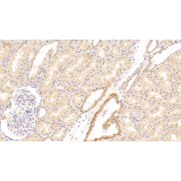 Hepatocyte Growth Factor (HGF) Human Polyclonal Antibody