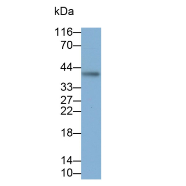 Inhibin Beta E (INHbE) Human Polyclonal Antibody
