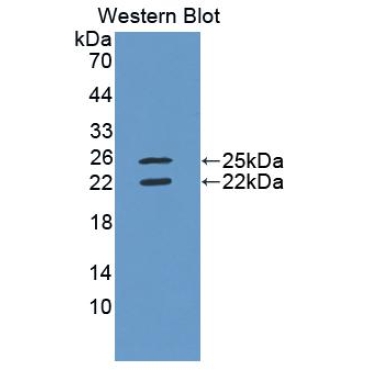 Interferon Gamma (IFNg) Human Polyclonal Antibody