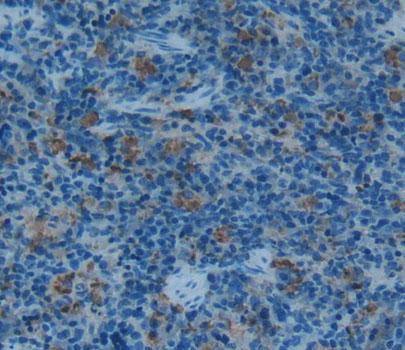 Interferon Gamma (IFNg) Rat Polyclonal Antibody