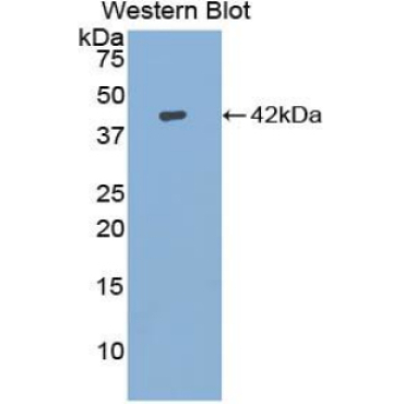 Insulin Like Growth Factor 1 (IGF1) Bovine (Cattle) Polyclonal Antibody