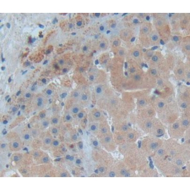 Insulin Like Growth Factor 1 (IGF1) Human Polyclonal Antibody