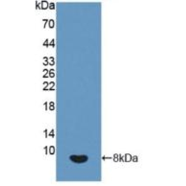 Insulin Like Growth Factor 2 (IGF2) Human Polyclonal Antibody