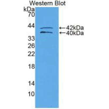 Insulin Like Growth Factor Binding Protein 1 (IGFBP1) Human Polyclonal Antibody