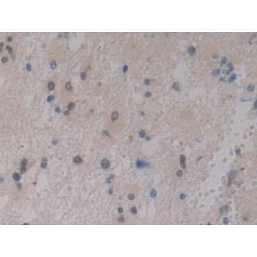 Insulin Like Growth Factor Binding Protein 1 (IGFBP1) Human Polyclonal Antibody