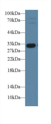 Insulin Like Growth Factor Binding Protein 1 (IGFBP1) Pig Polyclonal Antibody