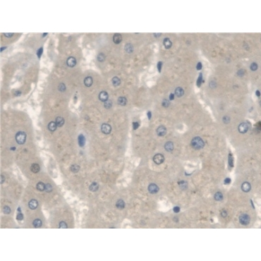 Insulin Like Growth Factor Binding Protein 2 (IGFBP2) Human Polyclonal Antibody