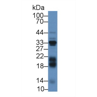 Insulin Like Growth Factor Binding Protein 3 (IGFBP3) Bovine (Cattle) Polyclonal Antibody
