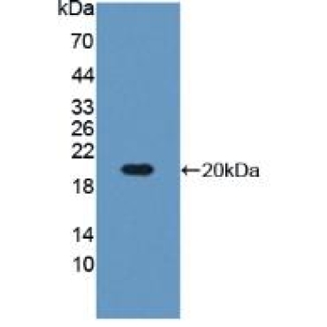 Insulin Like Growth Factor Binding Protein 3 (IGFBP3) Mouse Polyclonal Antibody
