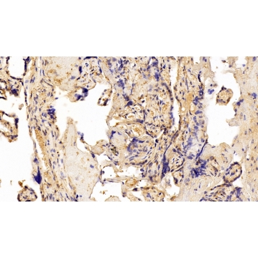 Insulin Like Growth Factor Binding Protein 4 (IGFBP4) Human Polyclonal Antibody