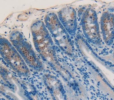 Insulin Like Growth Factor Binding Protein 4 (IGFBP4) Rat Polyclonal Antibody