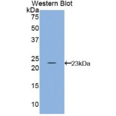 Interleukin 10 (IL10) Bovine (Cattle) Polyclonal Antibody