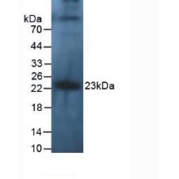 Interleukin 10 (IL10) Human Polyclonal Antibody