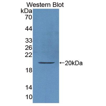 Interleukin 10 (IL10) Human Polyclonal Antibody