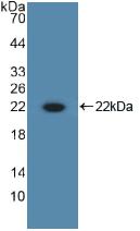 Interleukin 10 (IL10) Rabbit Polyclonal Antibody
