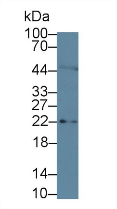 Interleukin 11 (IL11) Human Polyclonal Antibody