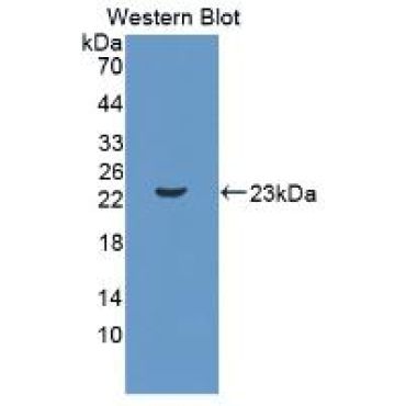 Interleukin 11 (IL11) Mouse Polyclonal Antibody
