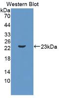 Interleukin 11 (IL11) Mouse Polyclonal Antibody