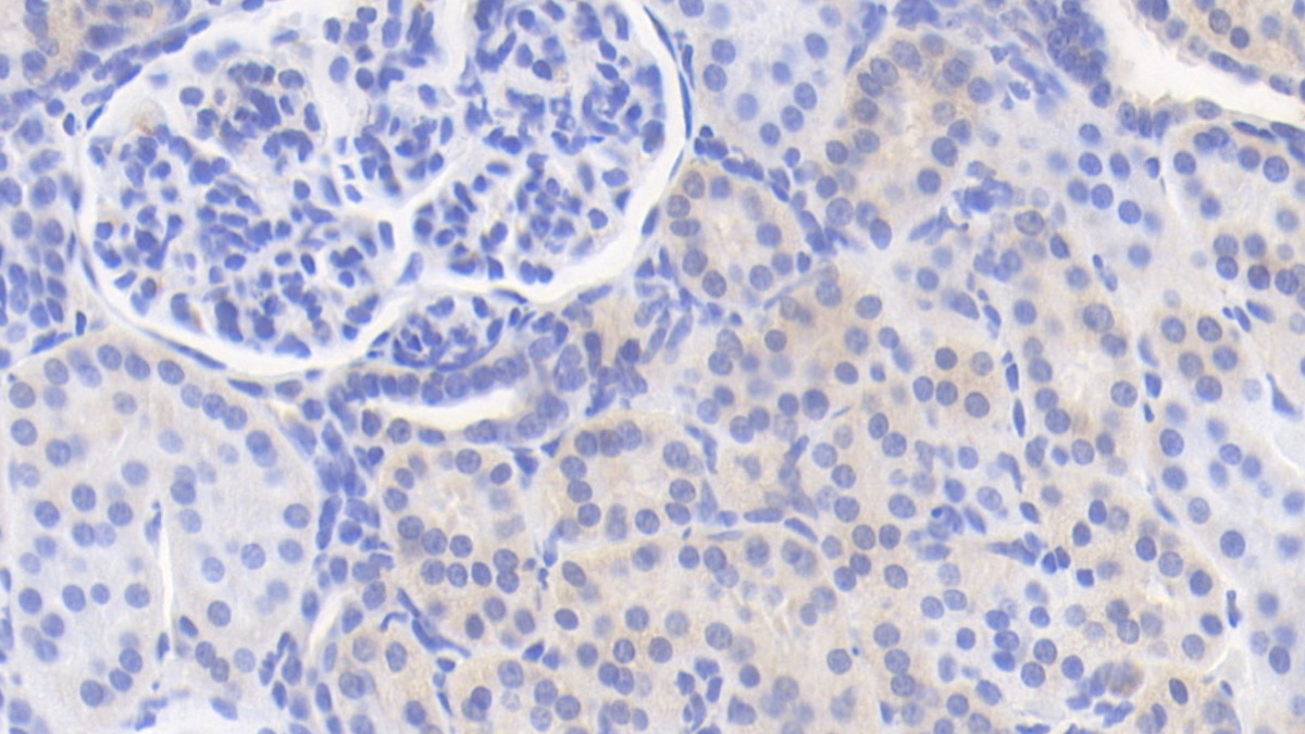 Interleukin 12B (IL12B) Pig Polyclonal Antibody