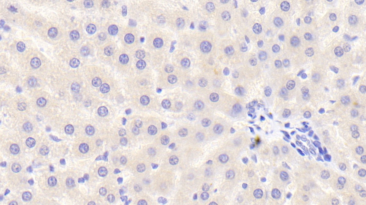 Interleukin 12B (IL12B) Rat Polyclonal Antibody