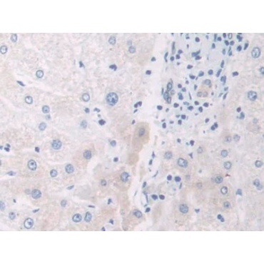 Interleukin 12A (IL12A) Human Polyclonal Antibody