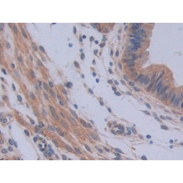 Interleukin 12A (IL12A) Mouse Polyclonal Antibody