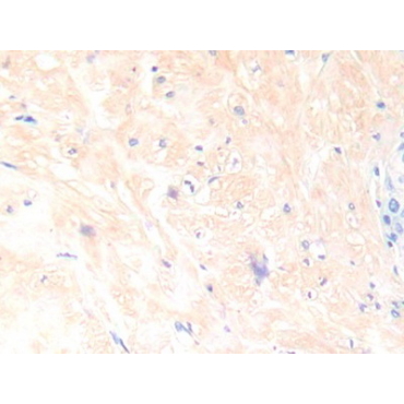 Interleukin 13 (IL13) Human Polyclonal Antibody