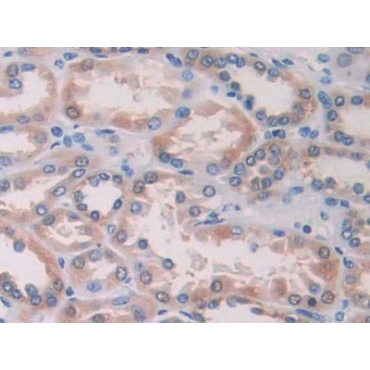 Interleukin 15 (IL15) Human Polyclonal Antibody
