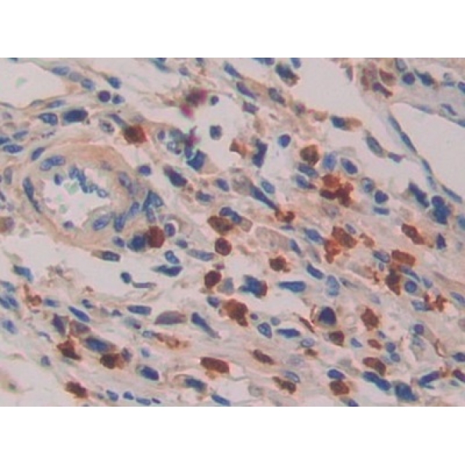Interleukin 16 (IL16) Human Polyclonal Antibody