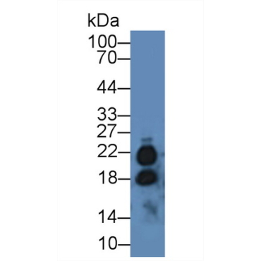 Interleukin 17 (IL17) Human Polyclonal Antibody