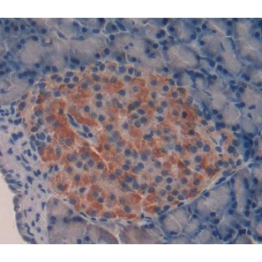 Interleukin 17 (IL17) Human Polyclonal Antibody
