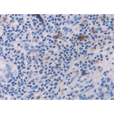 Interleukin 18 (IL18) Human Polyclonal Antibody