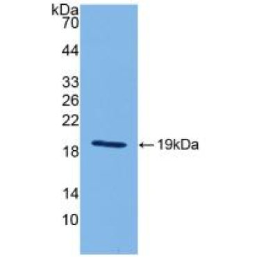Interleukin 18 (IL18) Mouse Polyclonal Antibody