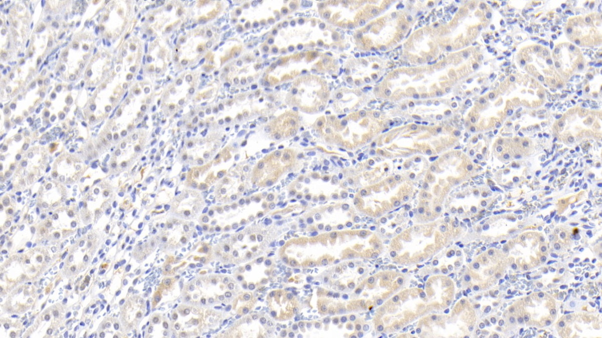 Interleukin 18 (IL18) Rabbit Polyclonal Antibody
