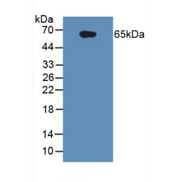 Interleukin 1 Receptor Type I (IL1R1) Human Polyclonal Antibody