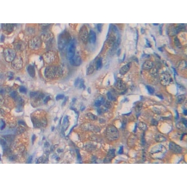 Interleukin 1 Receptor Type I (IL1R1) Human Polyclonal Antibody