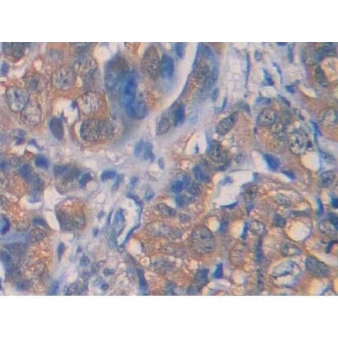 Interleukin 1 Receptor Type I (IL1R1) Human Polyclonal Antibody