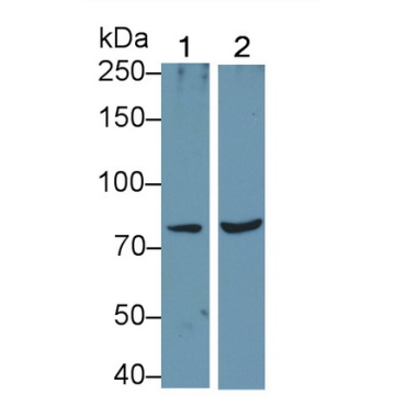 Interleukin 1 Receptor Type I (IL1R1) Human Polyclonal Antibody