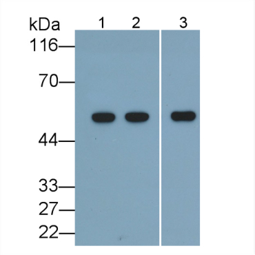 Glial Fibrillary Acidic Protein (GFAP) Human Polyclonal Antibody