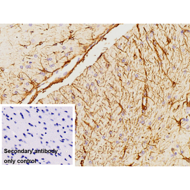 Glial Fibrillary Acidic Protein (GFAP) Human Polyclonal Antibody